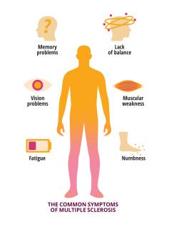 Common symptoms of multiple sclerosis